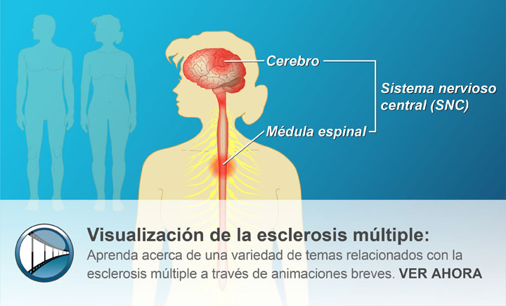 Aprenda acerca de una variedad de temas relacionados con la esclerosis múltiple a través de animaciones breves. VER AHORA 